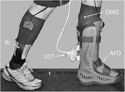 The Effect of Ankle Foot Orthosis' Design and Degree of Dorsiflexion on Achilles Tendon Biomechanics—Tendon Displacement, Lower Leg Muscle Activation, and Plantar Pressure During Walking